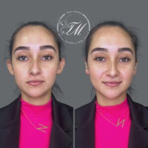 Tamiris Mendonça Otomodelação