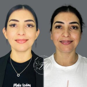 Tamiris Mendonça Otomodelação