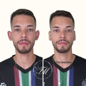 Tamiris Mendonça Otomodelação
