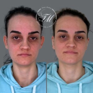 Tamiris Mendonça Otomodelação