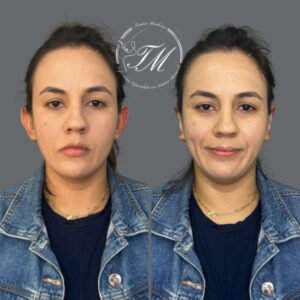 Tamiris Mendonça Otomodelação