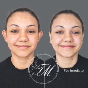 Tamiris Mendonça Otomodelação