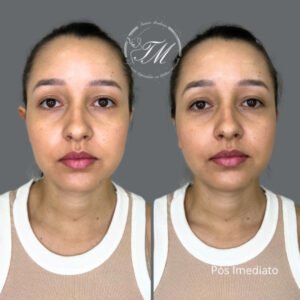 Tamiris Mendonça Otomodelação