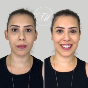 Tamiris Mendonça Otomodelação