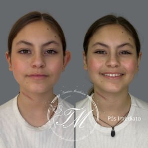 Tamiris Mendonça Otomodelação