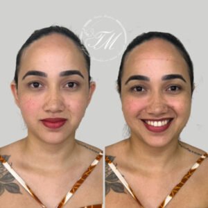 Tamiris Mendonça Otomodelação