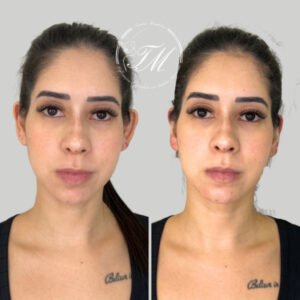 Tamiris Mendonça Otomodelação